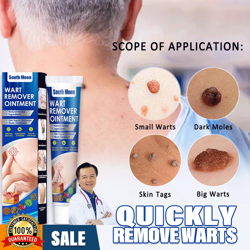 Warts Remover Original Kasoy Oil Cream Mole Skin Tag Wart Remover Genital Removal Original 8809