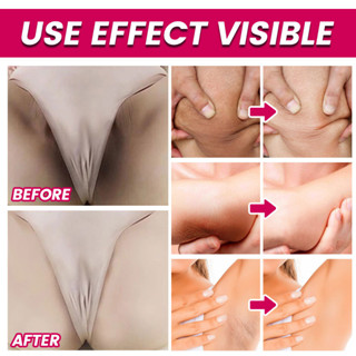 Whitening Cream Underarm Cream Butt Whitening Cream Face and Body Whitening Bikini Bleaching Cream #8