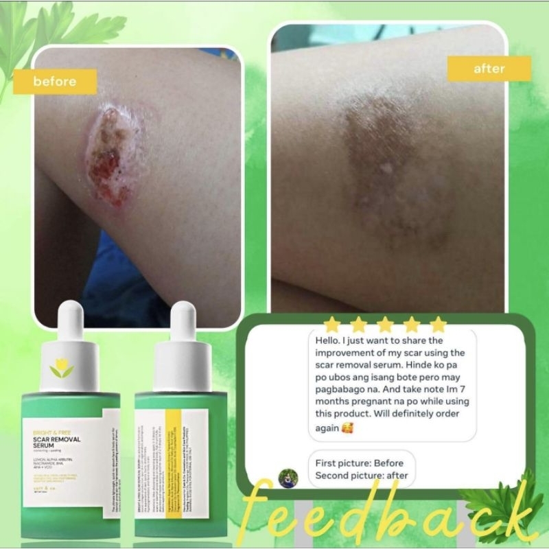 SCAR REMOVAL SERUM CATT & CO. SCAR REMOVER - Image 4