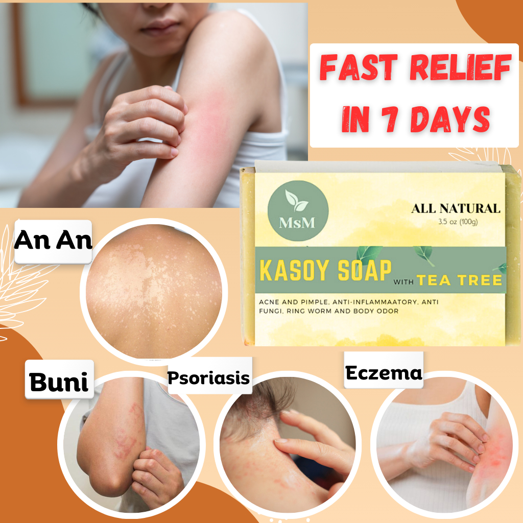 Shop an an skin for Sale on Shopee Philippines