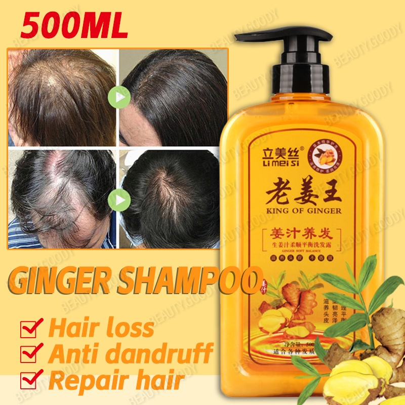 Ginger Shampoo Anti Hair Loss shampoo Hair Growth ginger scalp treatment  shampoo Oil Control | Shopee Philippines