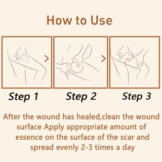 HEMEIEL Magic Scar Remover Gel Original/Leave no trace/Deep Scar Removal #4