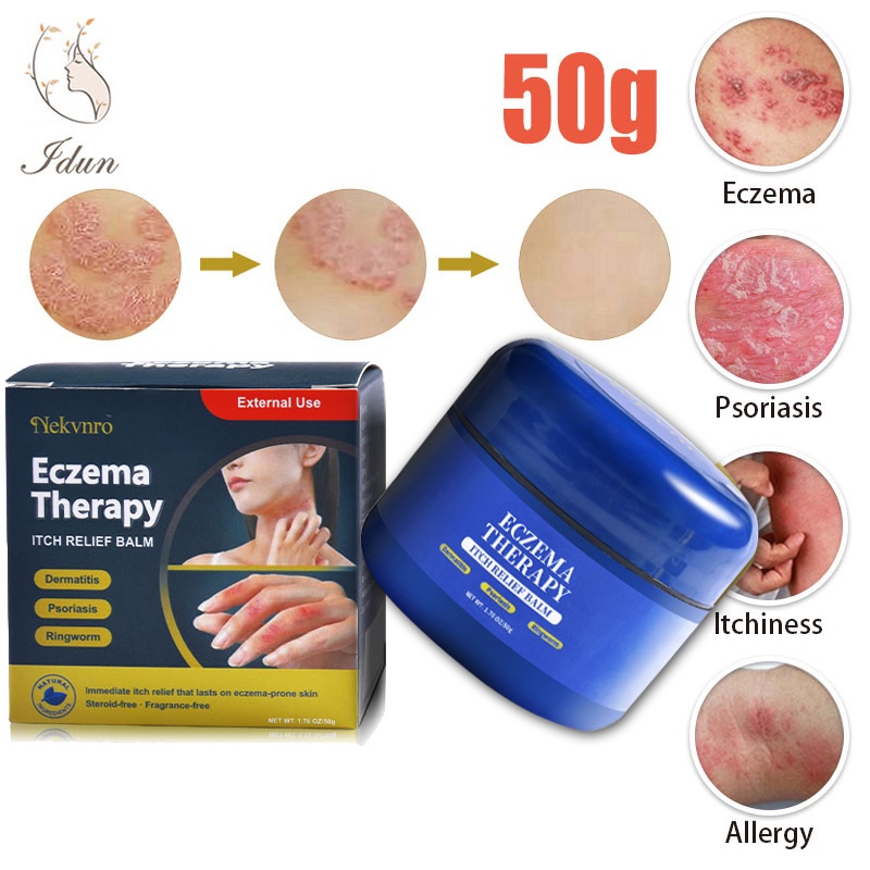 Idun 50g Eczema Therapy cream Eczema Psoriasis Treatment Cream Topical