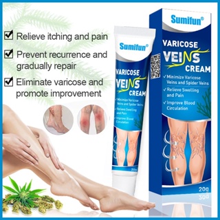 100% effective Varecose vein ointment Intravenous cream varicouse ointment Dredge tendons ointment
