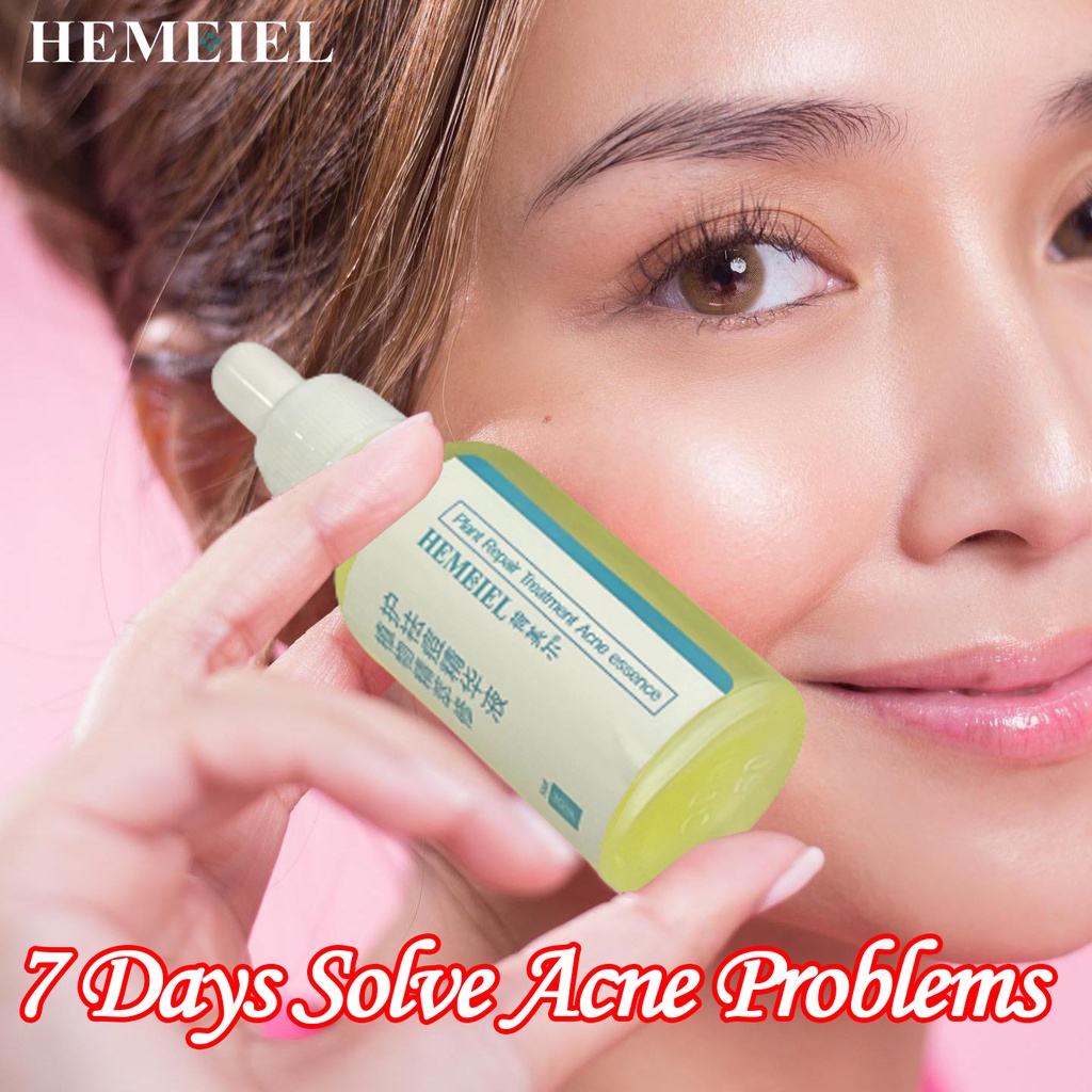 HEMEIEL Pimple Marks Acne Remover/Adapalene Clindamycin/Acne Treatment