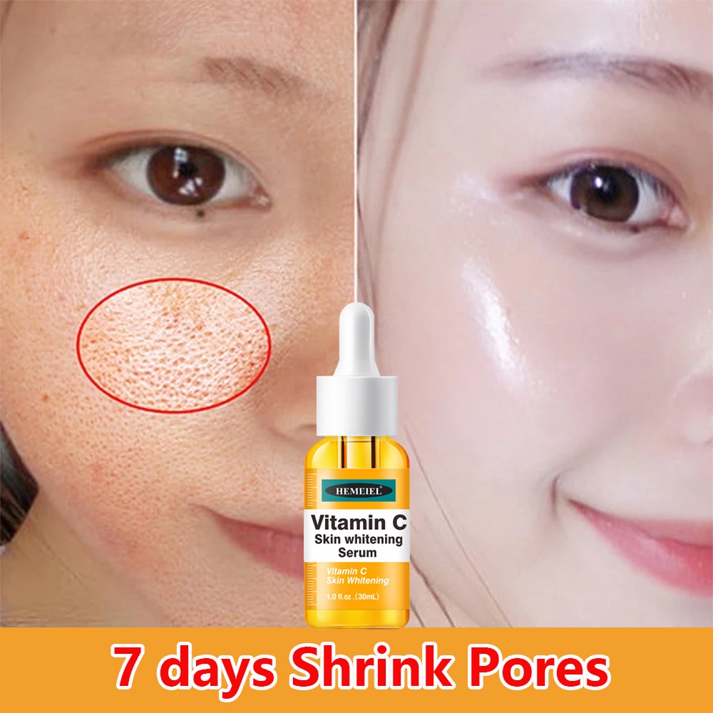 HEMEIEL Vitamin C Serum/White Melasma/Dark Spot Remover For Face