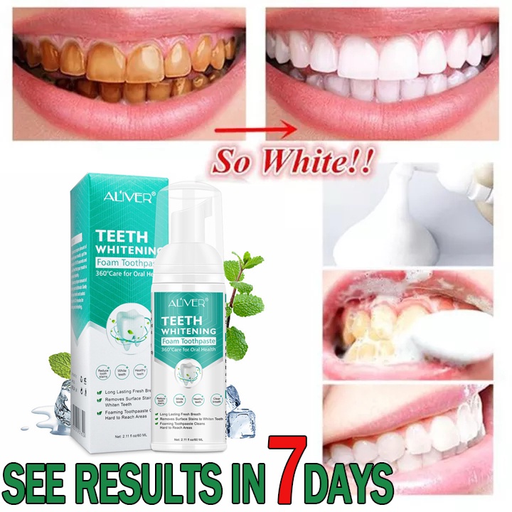ALIVER Teeth Whitening Mousse Toothpaste Cleansing teeth Mousse Remove