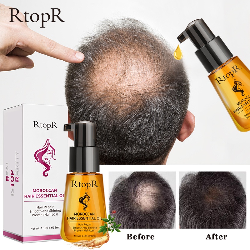 RtopR FDA Moroccan Prevent Hair Loss Product Hair Growth Essential
