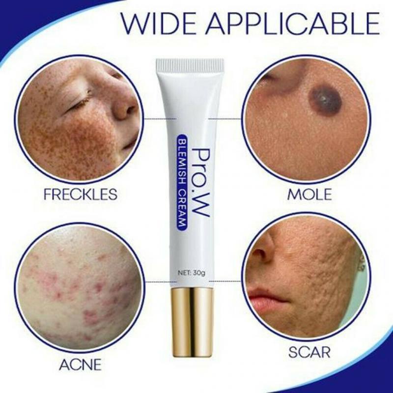 30g Blemish Cream Spots Removal Treatment Pimple Ointment Scar Anti Acne Cream Acne Skin Care White