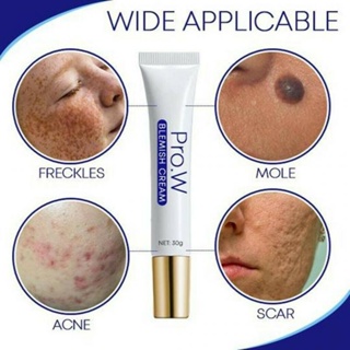30g Blemish Cream Spots Removal Treatment Pimple Ointment Scar Anti Acne Cream Acne Skin Care White #4