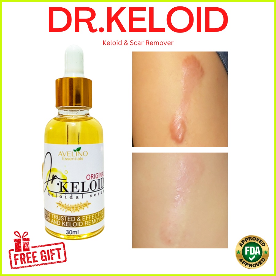 DR.KELOID Original Keloid / Scar Remover 30ml ( old scar / keloid