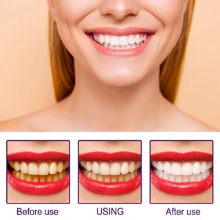 Teeth Whitening Pen Repair Bright White Anti-Sensitive Remove Smoke Stains Plaque Tooth Whitening Pen #4
