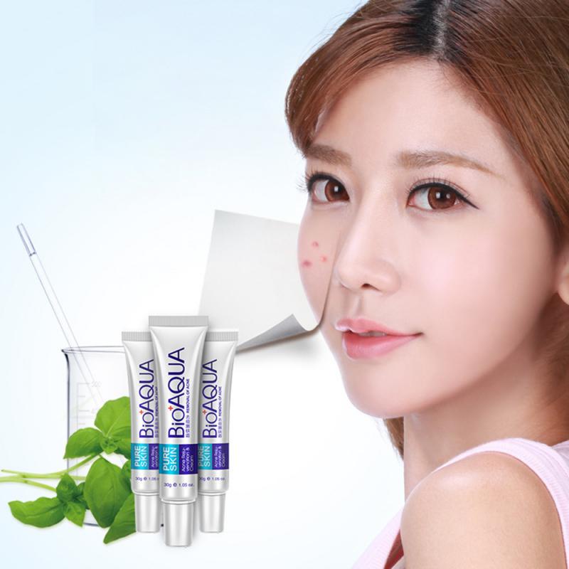 ⊙30g Anti Acne Cream Oil Control Shrink Pore Acnes Scar Remove Moisturizing Gel Ointment Effective