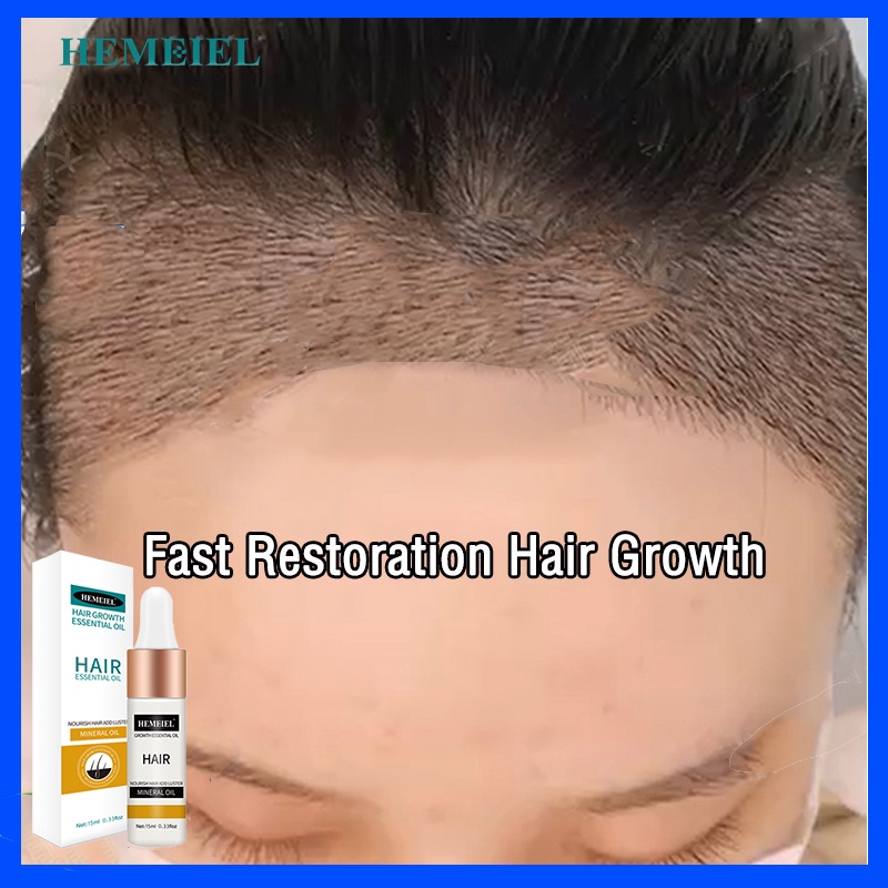 HEMEIEL Novu Hair Grower Pomade For Men Original/Hair Growth Serum Oil/Hair Thickener And Grower
