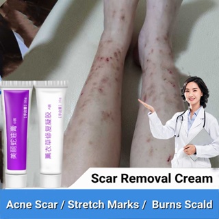 scarminator cream peklat remover scar removal cream stretch mark pimple acne gel keloid remover