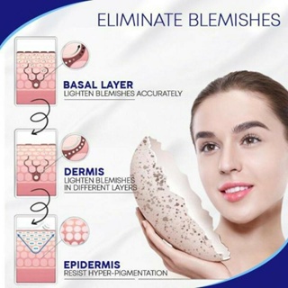 30g Blemish Cream Spots Removal Treatment Pimple Ointment Scar Anti Acne Cream Acne Skin Care White #6
