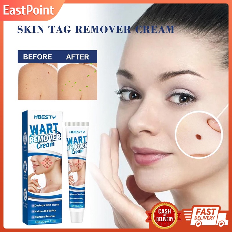 Warts Remover Original Cream Wart Removal Ointment Skin Tags Mole ...