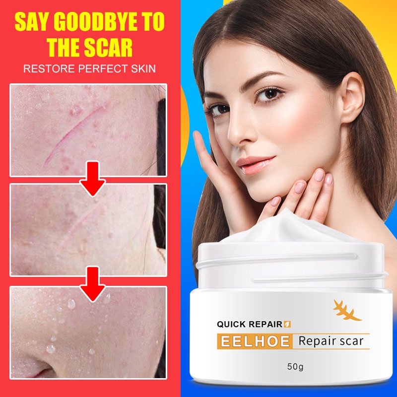 Scar Removal Cream Stretch Mark Removal Cream whitening Burn Repair Old