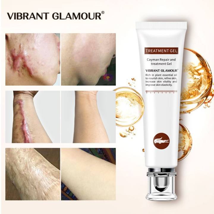 VG Scar Remover Acne Cream Scar Cream Scars Repair Stretch Marks Pregnancy Scars Scalded Surgery