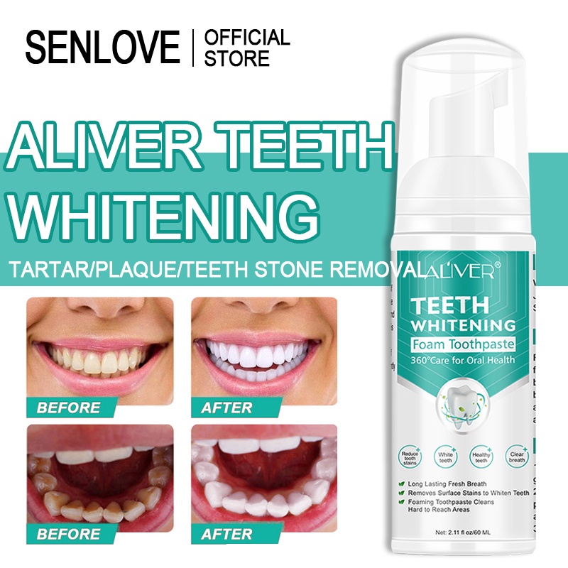 SENLOVE ALIVER Teeth whitening mousse toothpaste Remove Tartar Remove