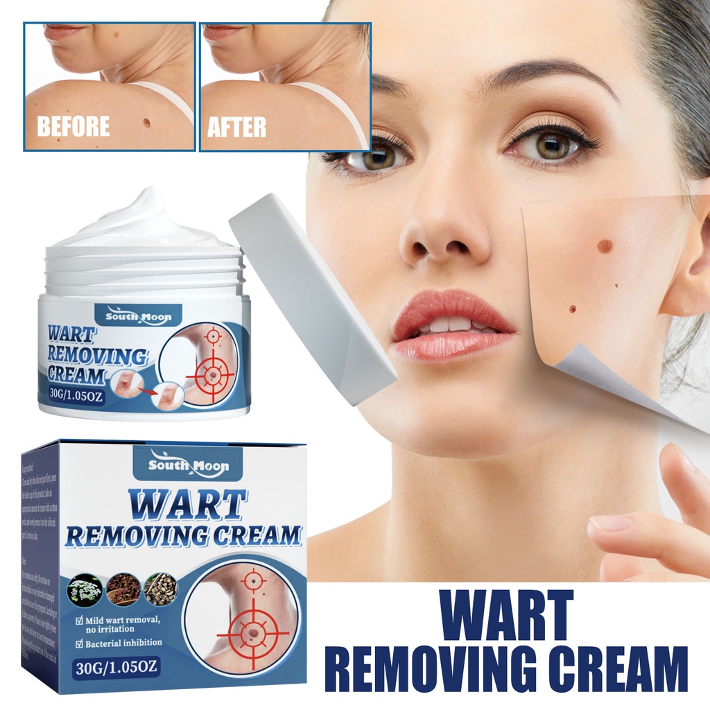 Skin Tag Remover Cream Painless Mole Skin Dark Spot Warts Remover Serum ...