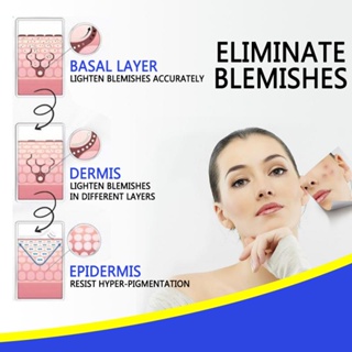 ▲⊙1 Pcs NEW Blemish Cream Freckles Acne Pimple Spots Removal Treatment Pimple Ointment Scar Mark  A #5