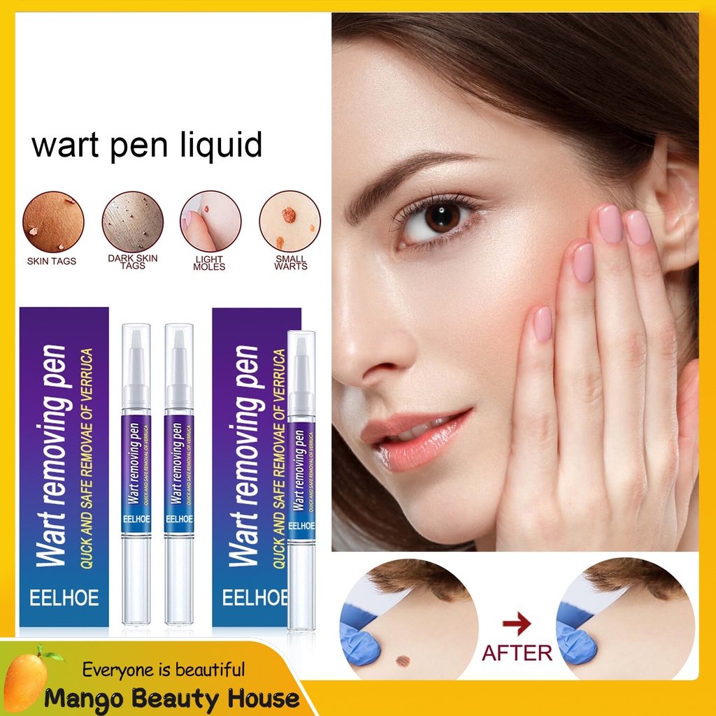 Cure Verruca Pen Cure Verruca Wart Flat Wart Acuminate Verruca Cure