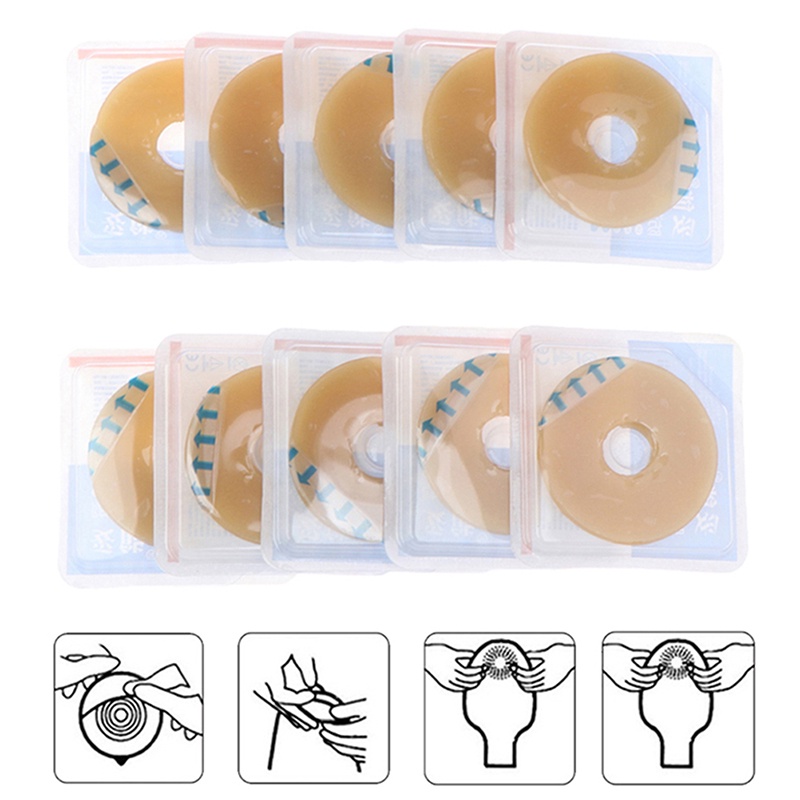 Ostomy Paste Ring Baseplates Stoma Care LeakProof Ring For Ostomy Bag