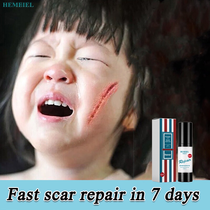 HEMEIEL Magic Scar Remover Gel Original/Children's Scar Remover/24k