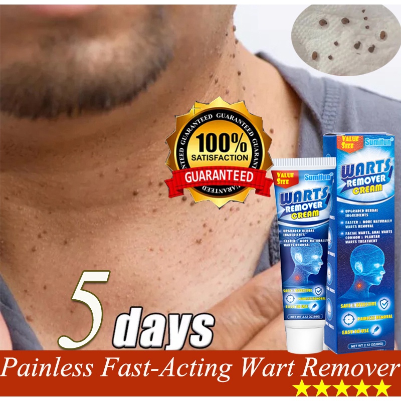 Warts Remover Cream warts remover original skin tag Remover Corn Plantar Wart Shopee Philippines