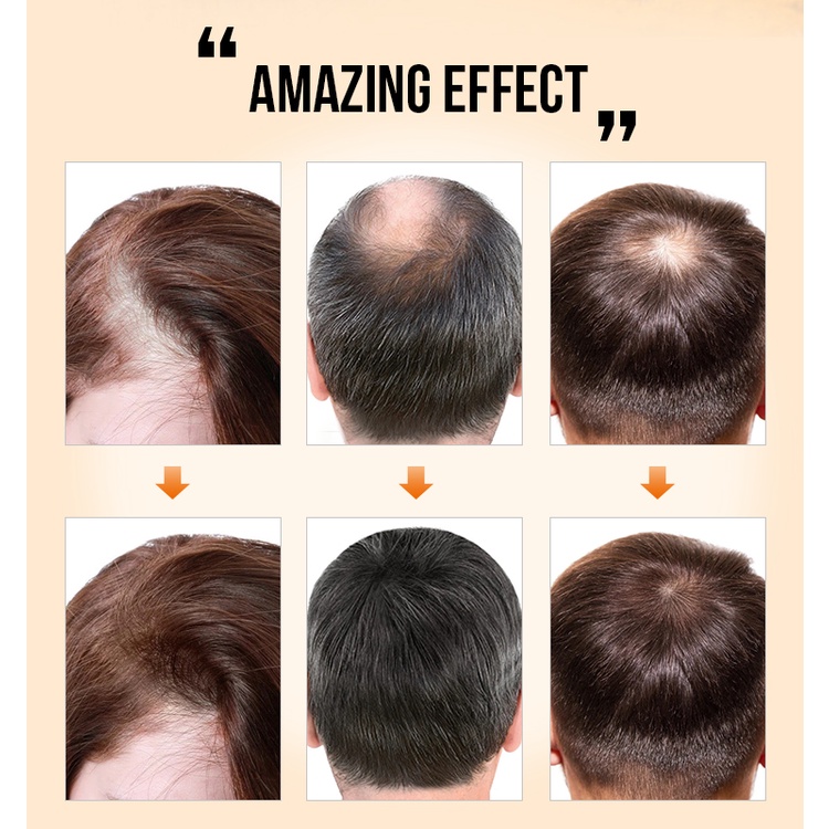 HEMEIEL Novu Hair Grower Pomade For Men Original/Hair Growth Serum Oil/Hair Thickener And Grower