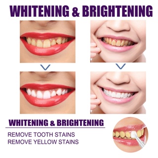 Teeth Whitening Pen Repair Bright White Anti-Sensitive Remove Smoke Stains Plaque Tooth Whitening Pen #3