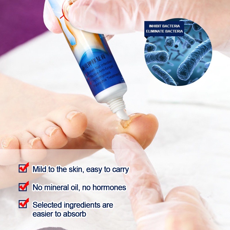 Nail Fungus Treatment Anti Fungal Cream 20g Fungisol Antifungal Nail Repair Cream Fungisol
