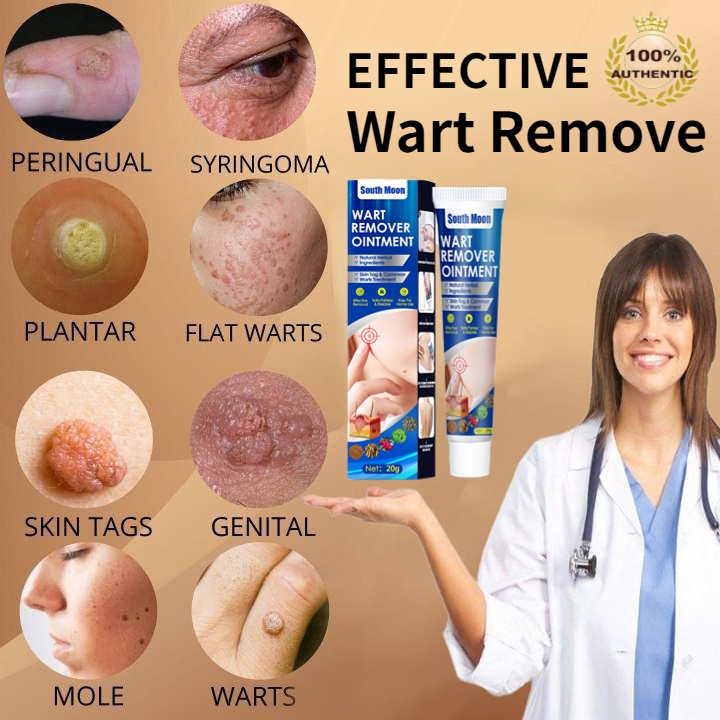 Painless warts removal genital warts & wart remover original mole ...