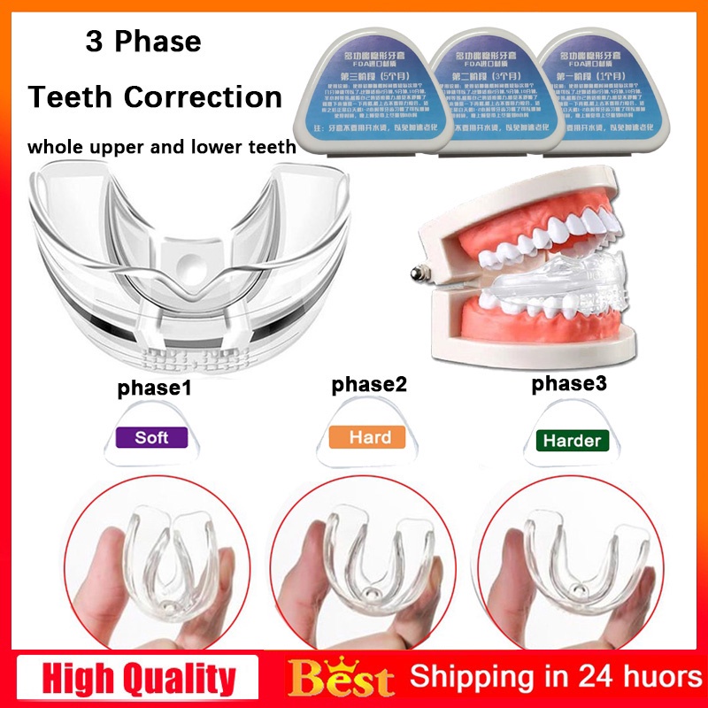 Yunos Dental Tooth Orthodontic Appliance Teeth Alignment Teeth Aligner