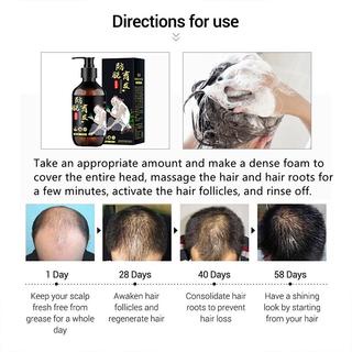 Hair Growth Shampoo Promote Hair Growth Oil Control Repairs Damaged Scalp Anti Hair Loss Shampoo kkm