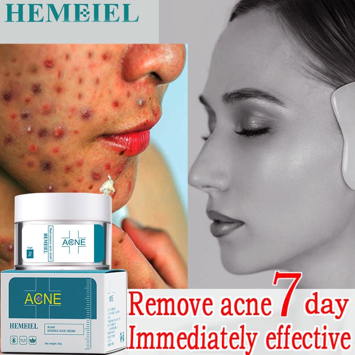 Hemeiel Pimple Marks Remover Cream / Effective Pimple Remover/Acne Scar