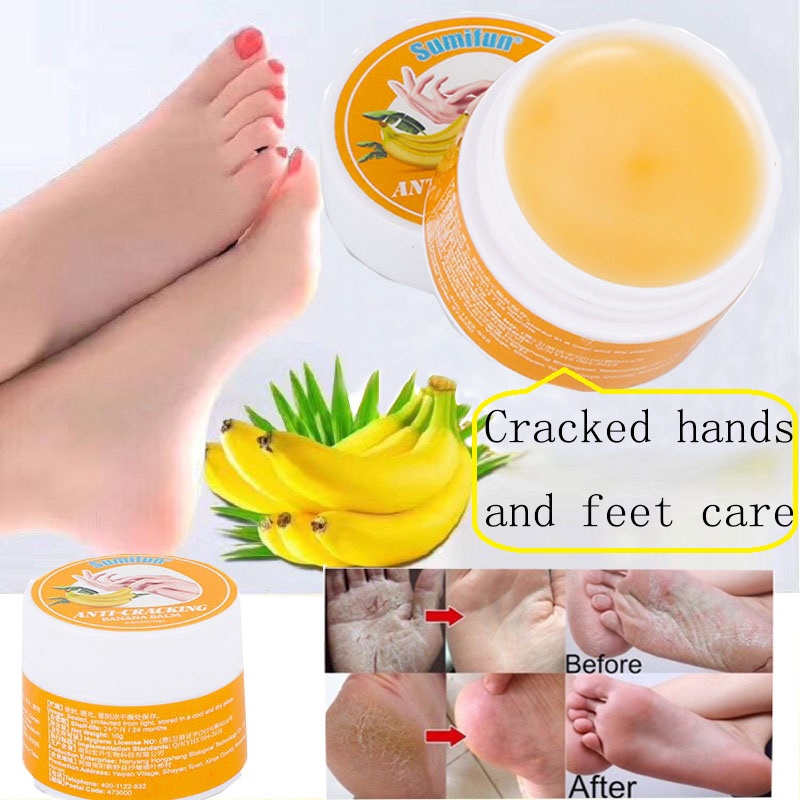 moisturizing cream Foot Heel Whitening Hands Feet Cream Cracked Heel ...