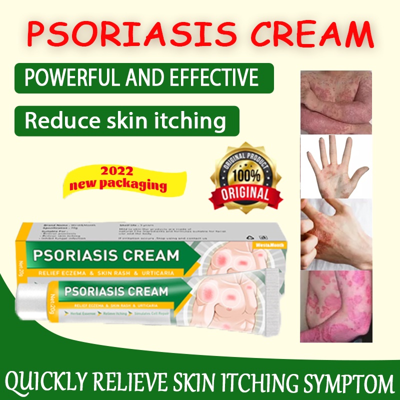 eczema psoriasis cream ointment eczema treatment cream ointment anti