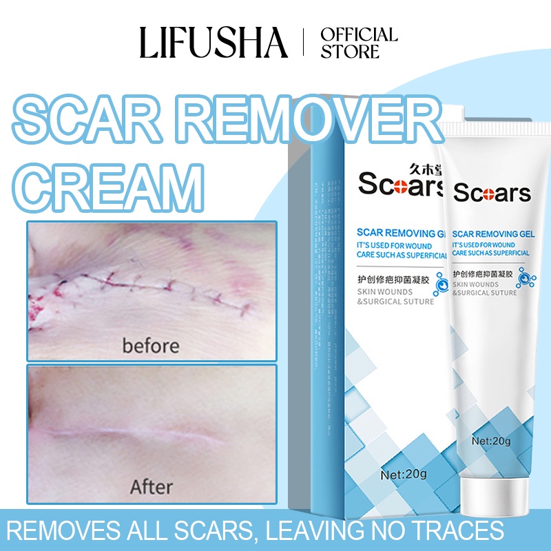 LIFUSHA Scar Removal Cream Peklat Remover Acne Treatment Scar remover