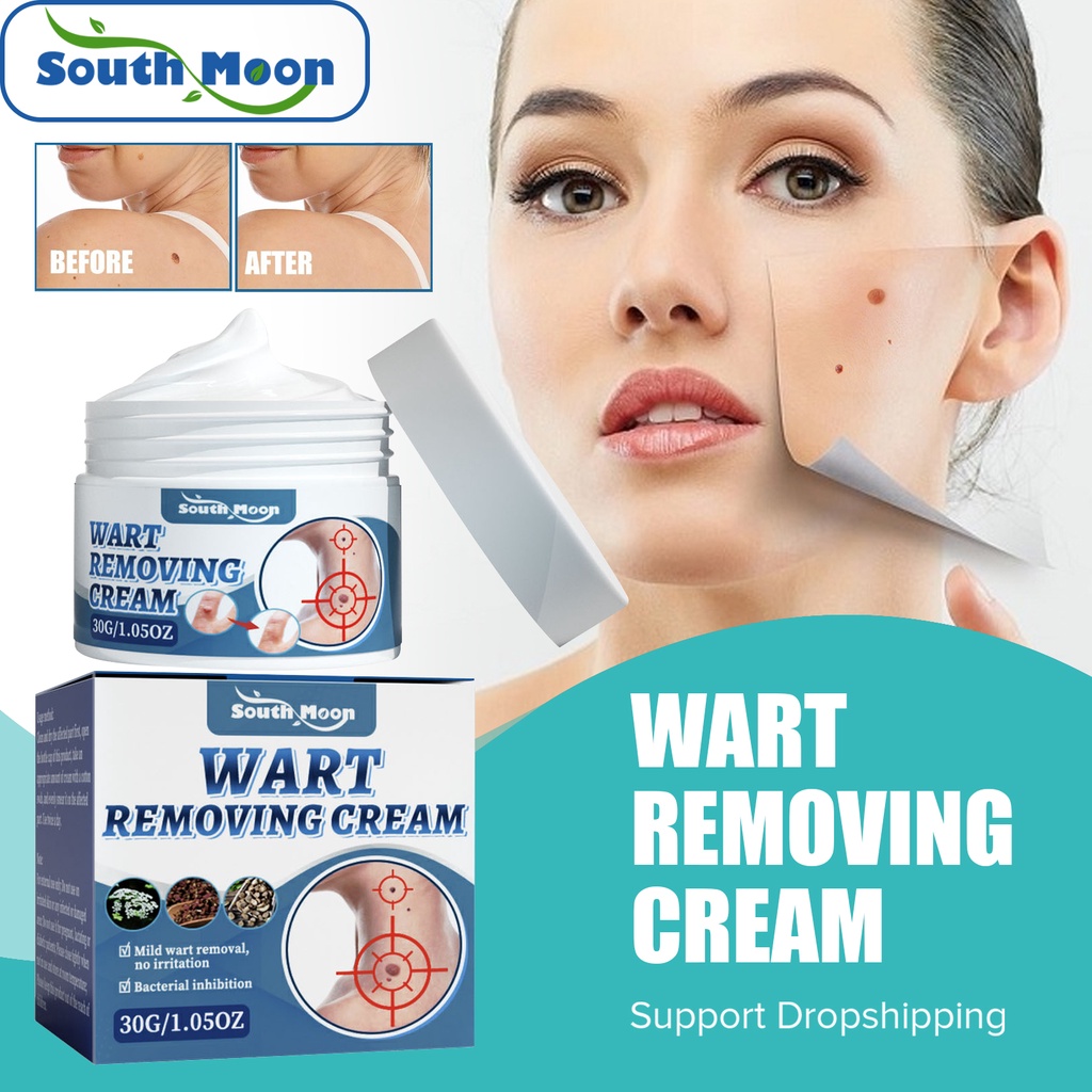 South Moon 30ml Wart Remover Cream Anti Moles Warts Face Corn Condyloma 