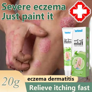 Dermatitis Eczema  cream Pruritus Cream Ointment  for eczema allergy ointment psoriasis  anti eczem