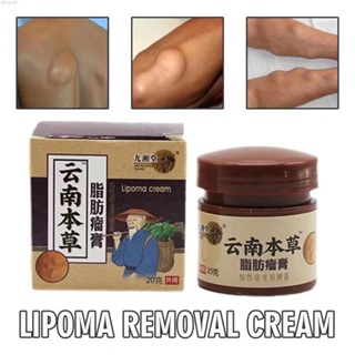 20g Lipoma Removal Cream Treat Tumor Skin Swelling Ointment Herbal