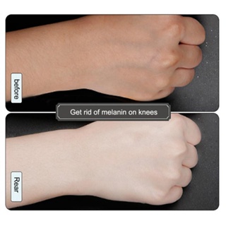 60ml Instant Whitening Cream Underarm Armpit Whitening Cream Legs Knees Private Parts Body Whitening #9