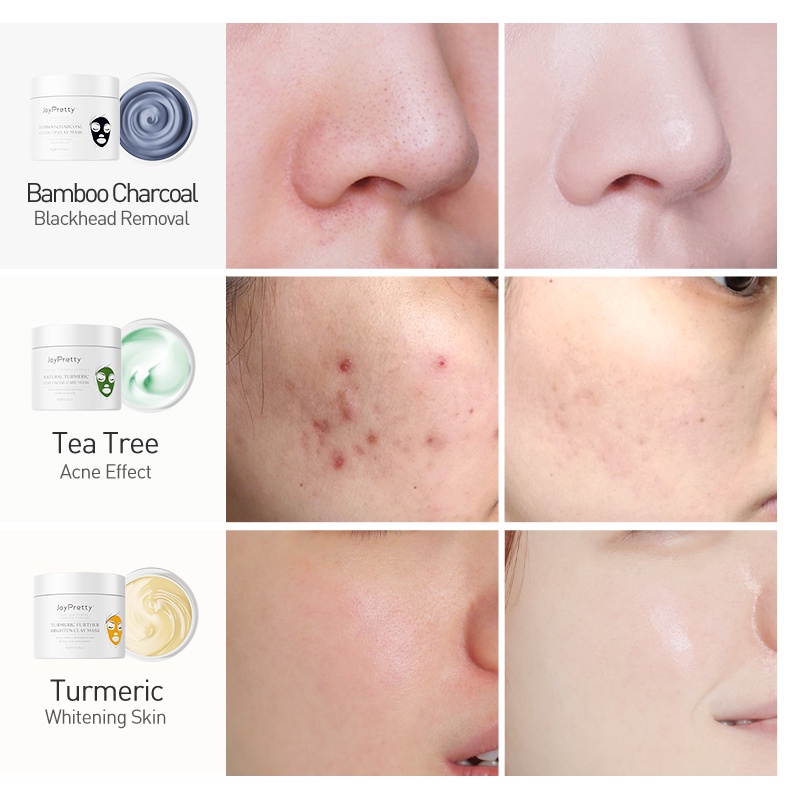 NEWCOD□Green Tea Tree Clay Mask Against Face Acne Blackhead Remover Mask Cream Facial Cleansing Bl