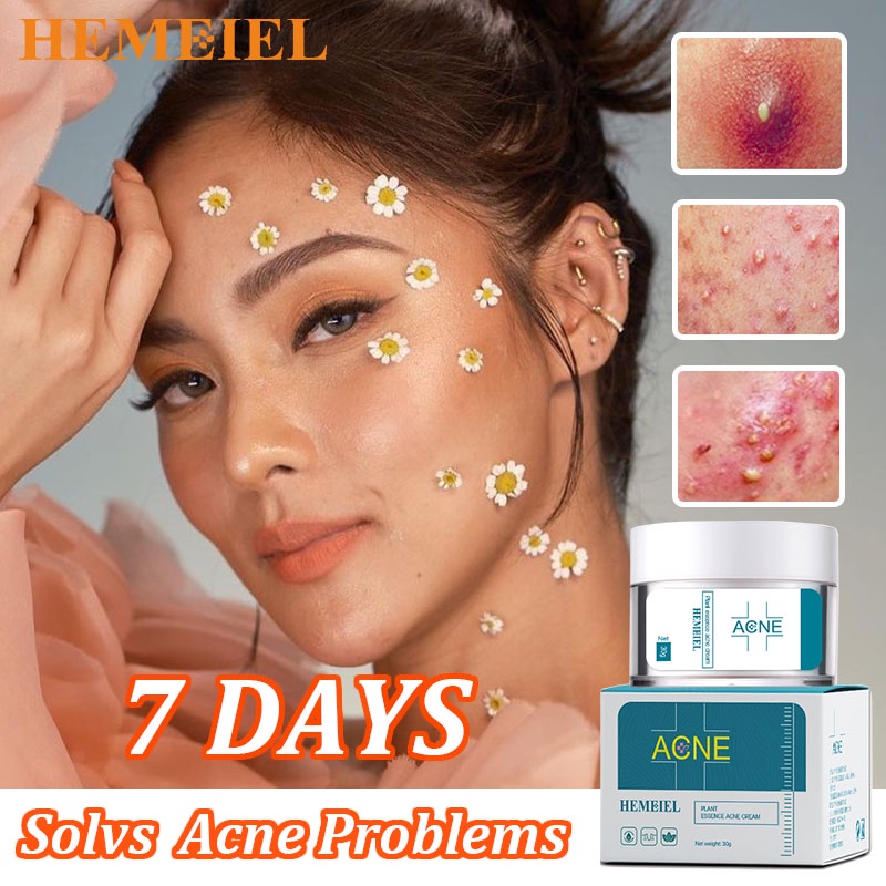 HEMEIEL Acne Treatment Cream | Adapalene Clindamycin | Pimple Marks
