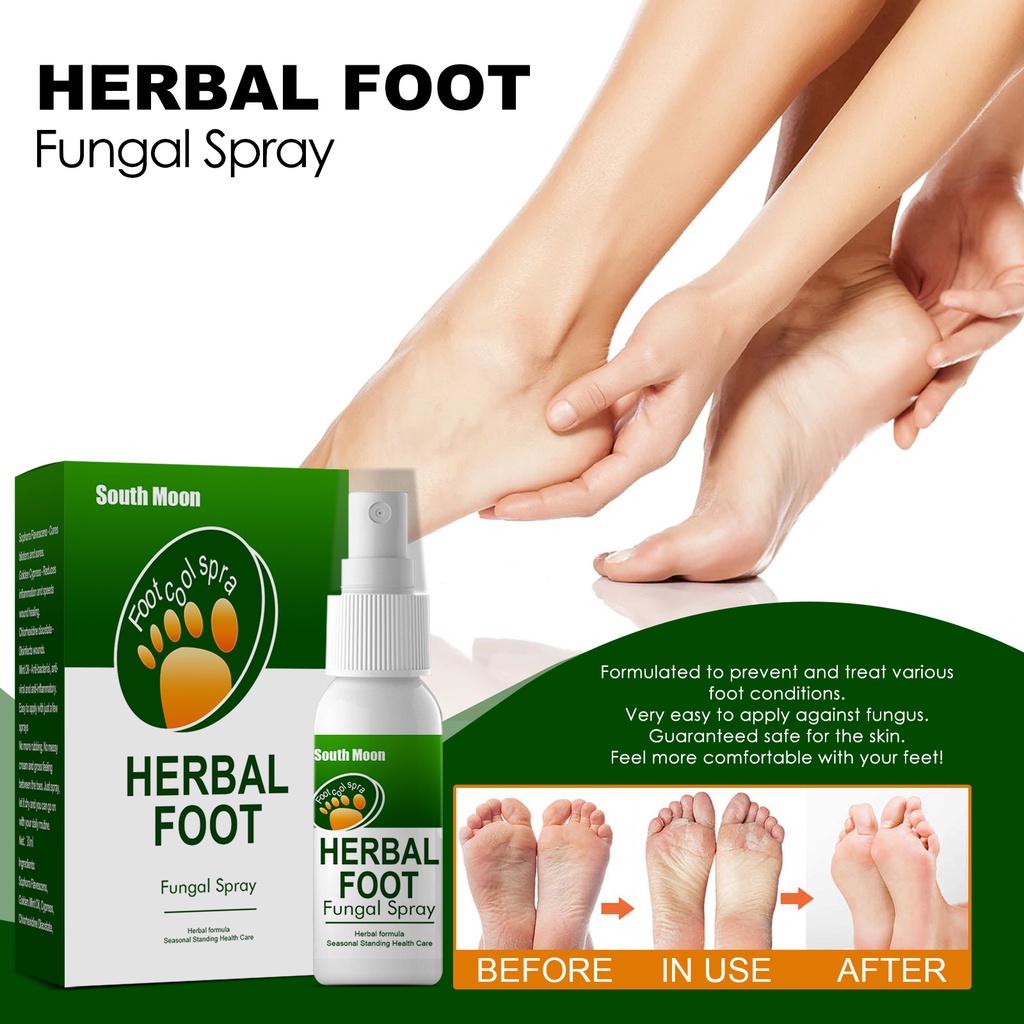 30ml Herbal Foot Spray Feet sweat, foot odor, itching relieving spray