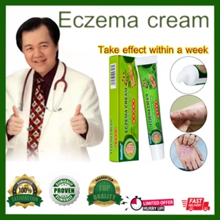 Eczema Cream Antibacterial Ointment Relief Itchy Skin Treatment eczema ointment
