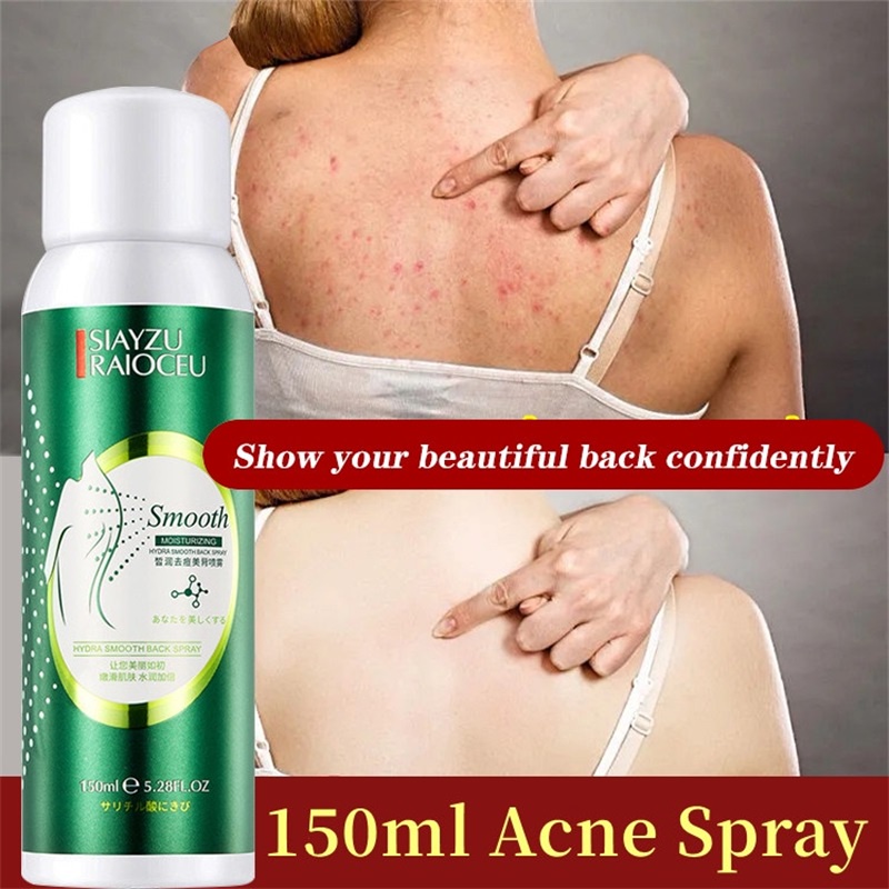 150ml Acne Remover Spray Back Acne Spray Remover Chest Back Mites Oil