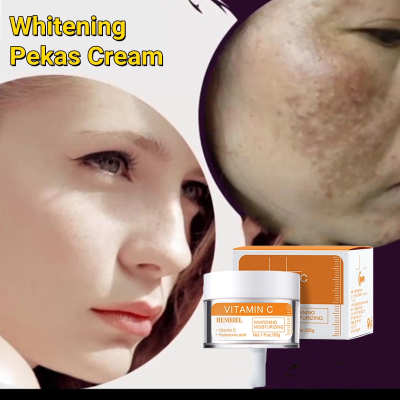 HEMEIEL Vitamin C Cream/Melasma Removal/Melasma Treatment/Melasma